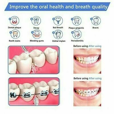 Ailifefort Water Flosser Cordless Rechargeable Portable Dental Oral Irrigator